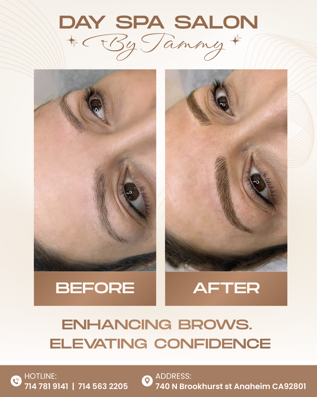 Enhancing brows, elevating confidence